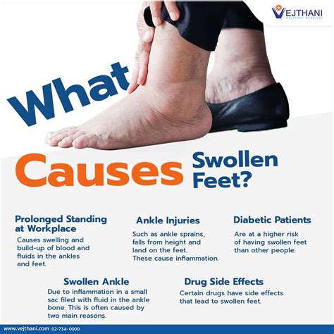 Reducing Swelling