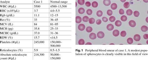 Reticulocyte Count