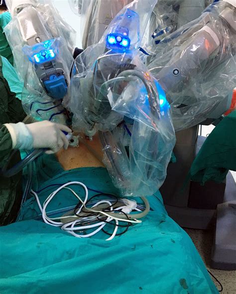 Robotic Hernia Repair Technology