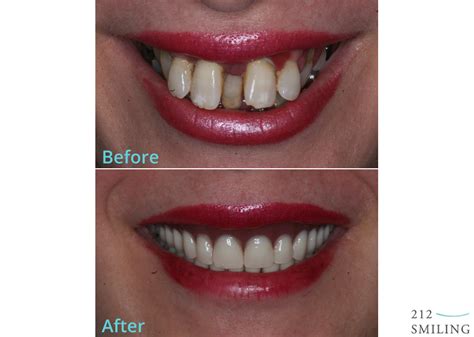 Same-Day Dental Services