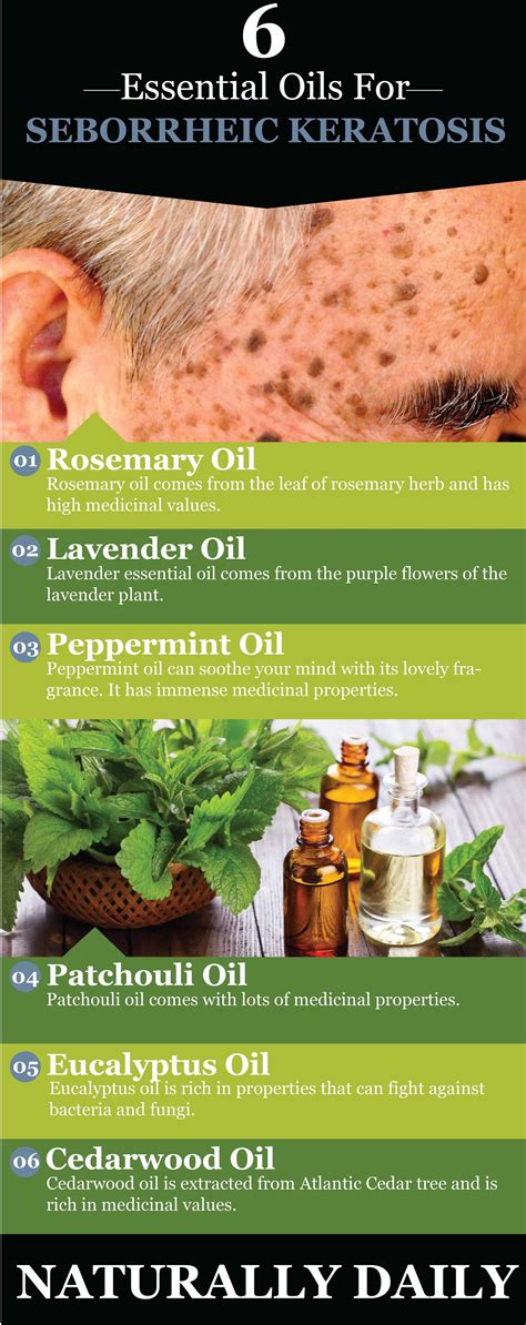 Seborrheic Keratosis Home Remedies