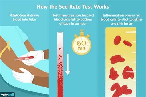 Sed Rate Results