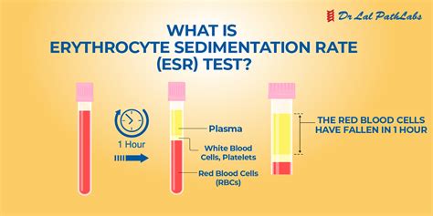 Sed Rate Test