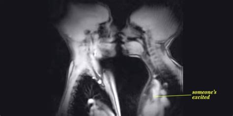 Sex Xray