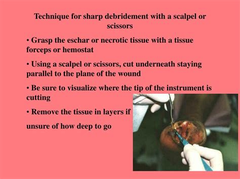 Sharp Debridement