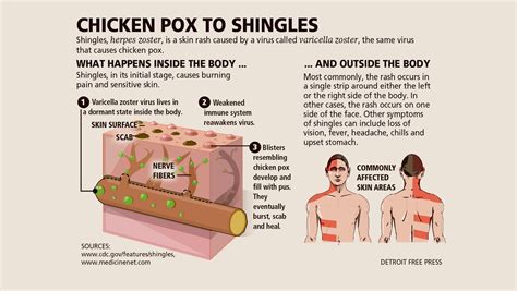 shingles long-term complications