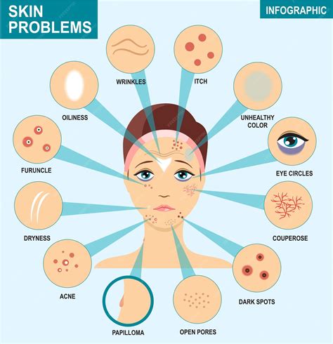 Common skin concerns