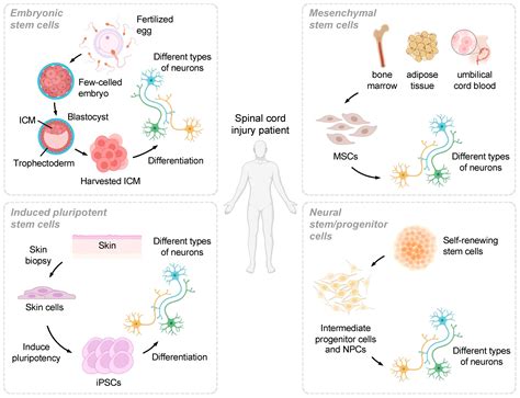 Stem Cell Therapy
