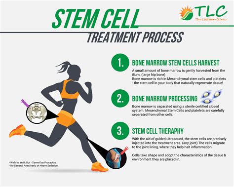 Stem Cell Therapy