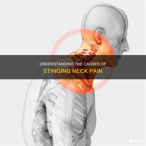 Stinging Pain