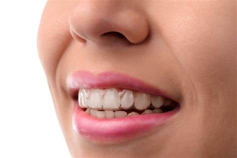 Straight Teeth