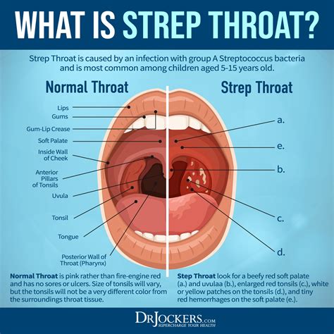 Strep Throat Swallowing