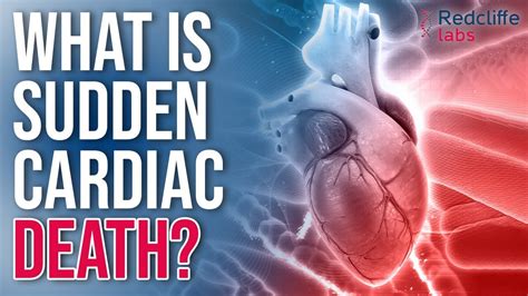Sudden Cardiac Death Risk