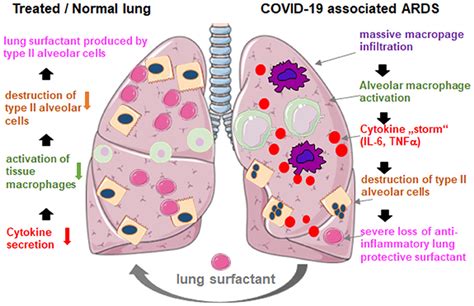 Surfactant in the lungs