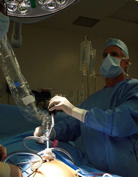 Surgical Excision