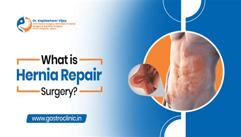 Surgical Hernia Operation