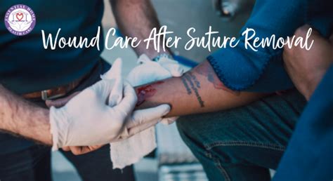 After suture removal care