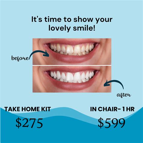 Teeth Whitening