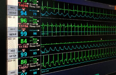 Telemetry nursing