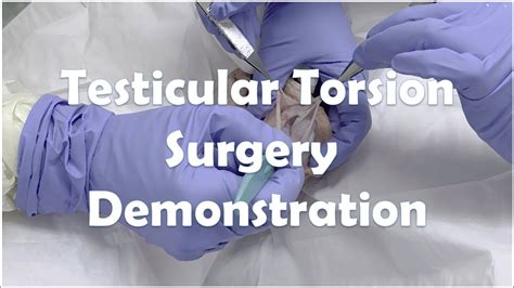 Testicular Torsion Surgery Procedure