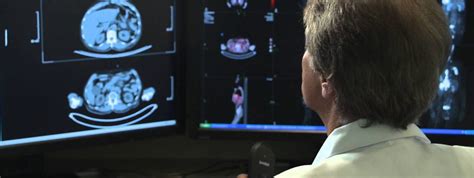 Tower Radiology Expert Radiologists