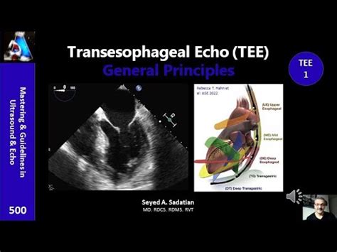 Transesophageal Echocardiogram TEE Procedure