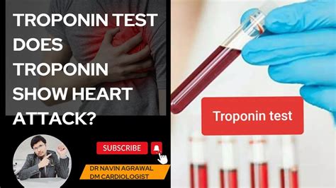 Troponin test