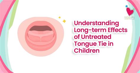 Untreated Tied Tongue