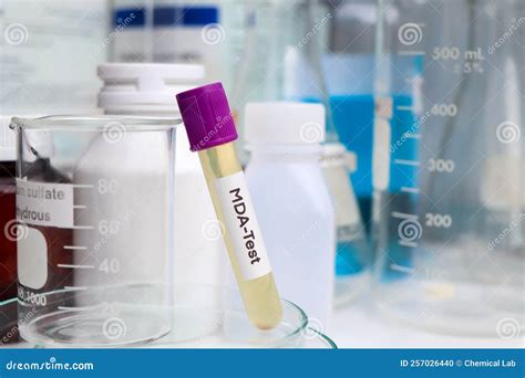 Urine Sample