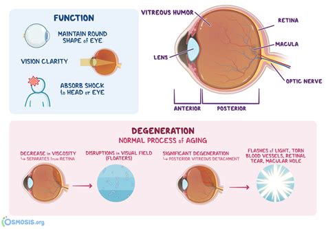 Vitreous Humor
