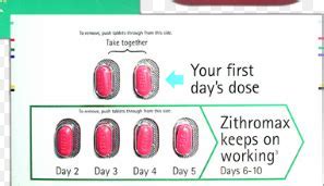 Z-Pack Antibiotic Treatment Explained